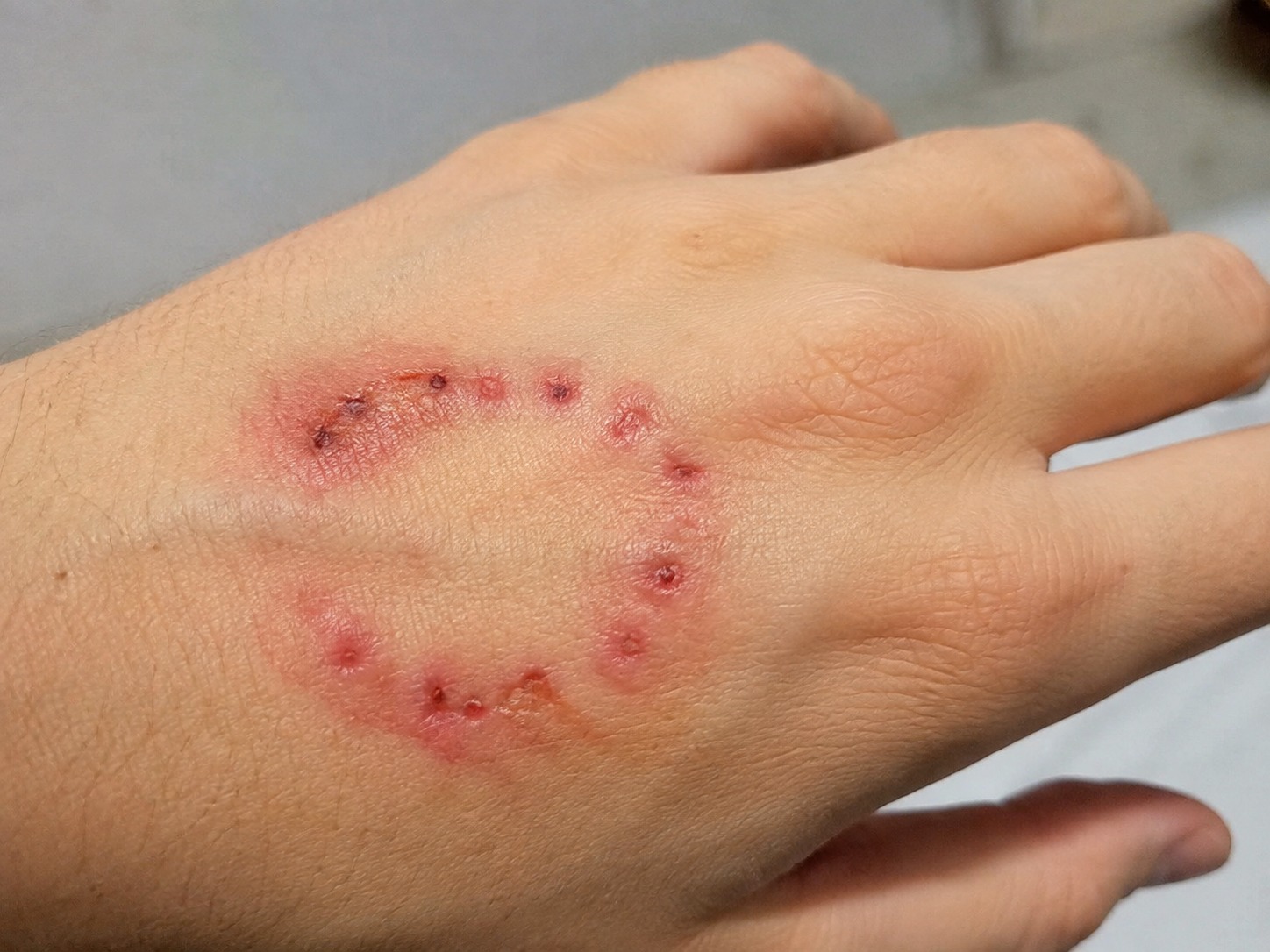  Homem é preso suspeito de agredir e morder esposa grávida de 36 semanas